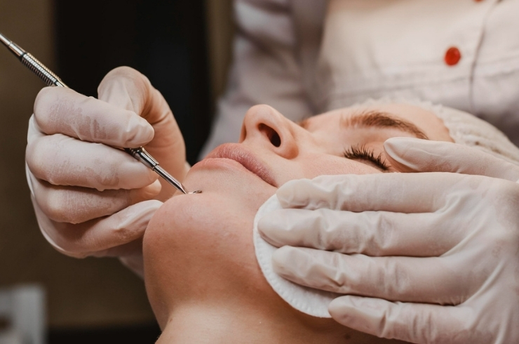 Dermaplaning